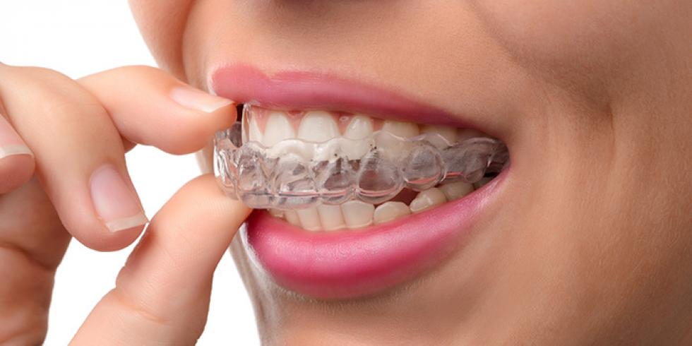 ochtendgloren Spookachtig onderwerp Opbeetplaat of knarsbitje in de behandeling van tandenknarsen |  e-gezondheid.be | Drupal